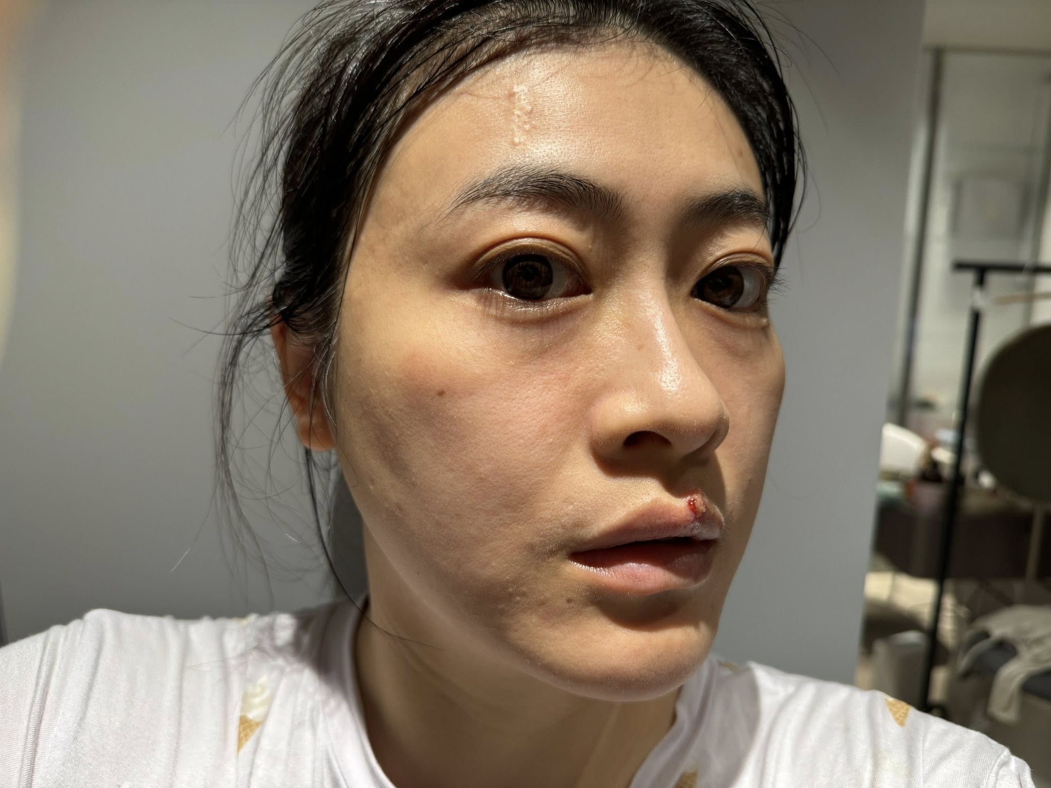只要3分鐘~養出逆齡美肌【20 BEAUTY DAY藍銅胜肽+玫瑰動能+早C晚A|強效保濕、抗老維穩、美白透亮】茜茜母親節獨家團購 只要3分鐘~養出逆齡美肌【20 BEAUTY DAY藍銅胜肽+玫瑰動能+早C晚A|強效保濕、抗老維穩、美白透亮】茜茜母親節獨家團購