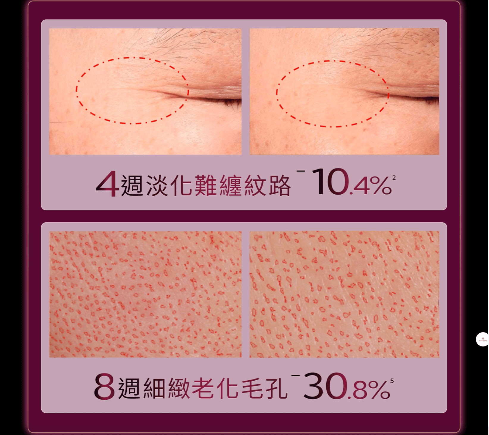 擺脫媽味+找回青春!【茜茜抗老三部曲:保濕抗糖、支撐力、立體度】日本COCOCHI+20BD+日本NIPPI+美國美膚儀 擺脫媽味+找回青春!【茜茜抗老三部曲:保濕抗糖、支撐力、立體度】日本COCOCHI+20BD+日本NIPPI+美國美膚儀