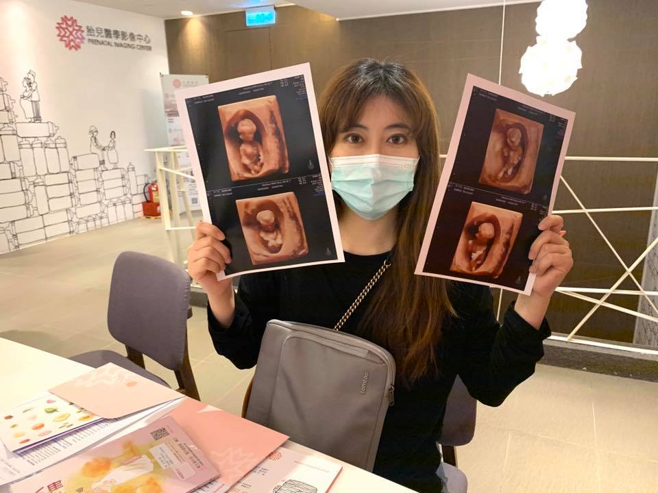 育兒第一桶金GET！中央+地方生育獎勵「10萬起跳」 這樣領不會漏